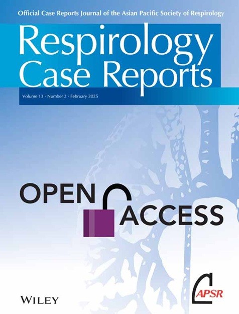 当講座 鍋谷 医員のcase reportがRespirology Case Reportsに掲載されました！